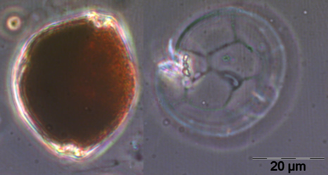 files/bio/ag-phytoplankton-oekologie/Alexandrium pseudogonyaulax1.jpg